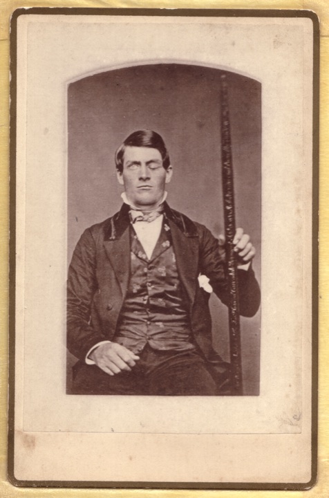 フィニアス・ゲージのダゲレオタイプ写真。事故で受けた鉄棒を持って撮影されている。1850年代撮影。